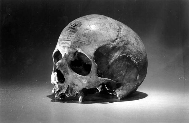 Craniul lui Alexander Pearce. University of Pennsylvania, Philadelphia. Wikipedia.