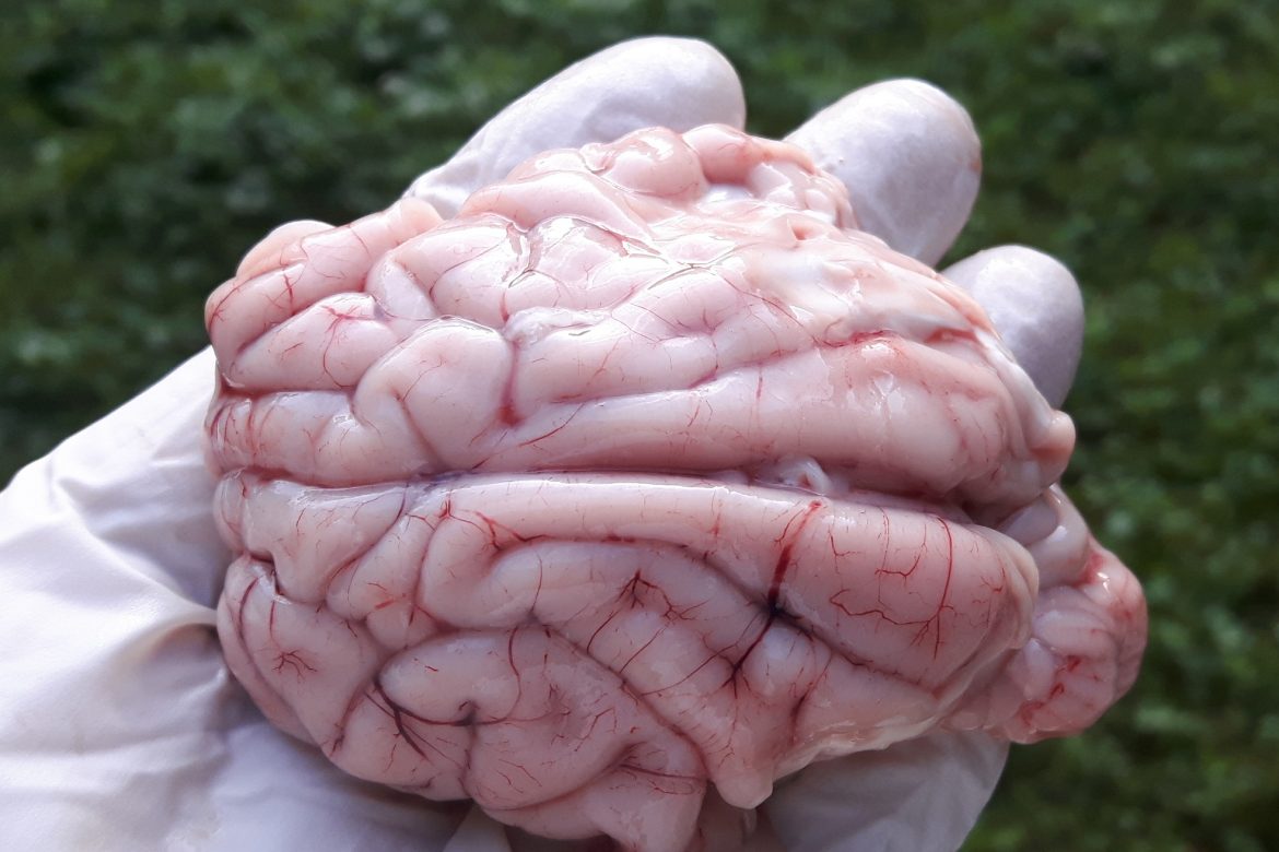 Vom putea să alimentăm direct creierul cu informaţii?
