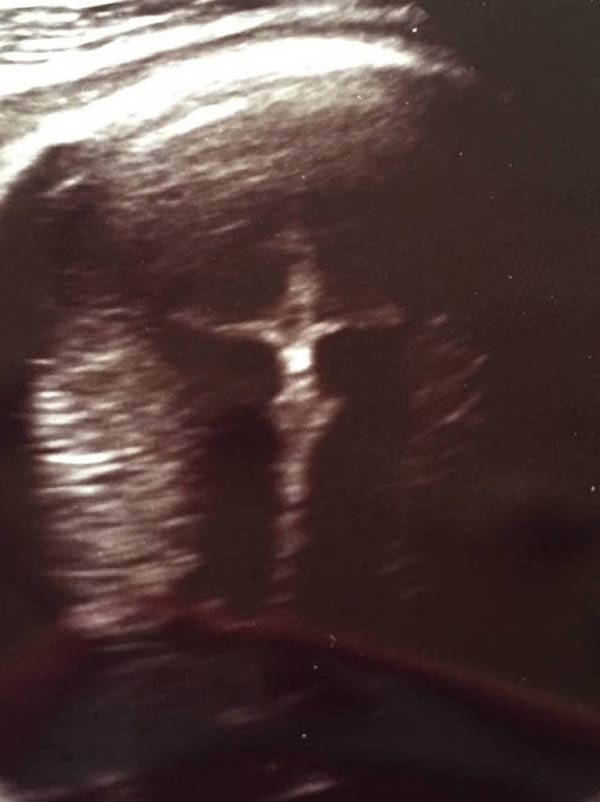 Iisus pe cruce a apărut pe o fotografie primită de la gincolog de o americancă